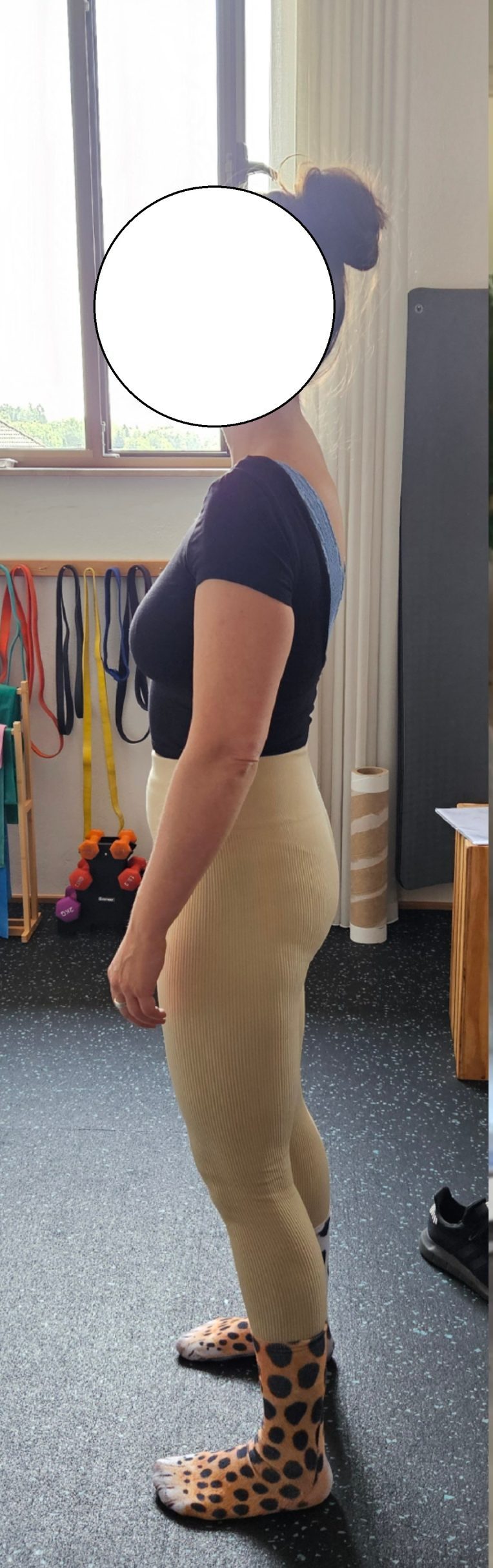 vaje v fitnesu s hernijo stanje varovanke pred vadbo medenica potisnjena naprej