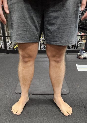 hoja s stopali navzven — pogled na postavitev stopal pri hoji