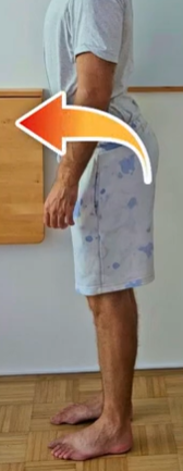 medenica nagnjena naprej in hoja s stopali navzven — anteriorna rotacija medenice