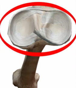 meniskus pogled od zgoraj anatomija kolena poškodba meniskusa