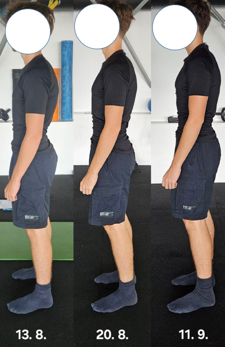 Maks telesna drža napredek od 13.8. do 11.9. sprememba orientacije medenice prsni koš