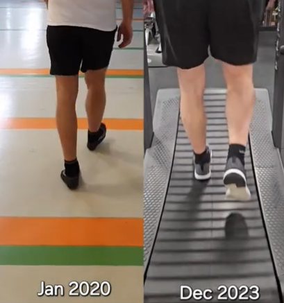 hoja s stopali navzven pred in po treningih — izboljšan vzorec hoje