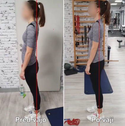 telesna drža pred in po vaji sprememba težišča medenica erektorji ekscentričen položaj
