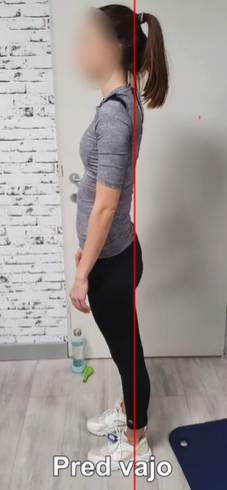telesna drža pred vajo anteriorni nagib medenice težišče naprej erektorji