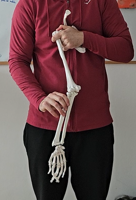 valgus komolca — notranja rotacija roke, vzorec enak kot pri valgusnem kolenu