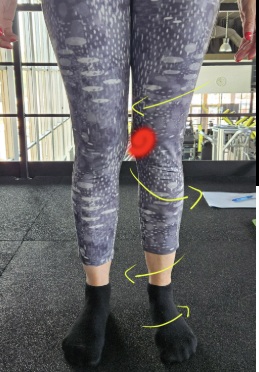 vijačenje kolena pritisk na notranji del kolena obraba meniskus plazma