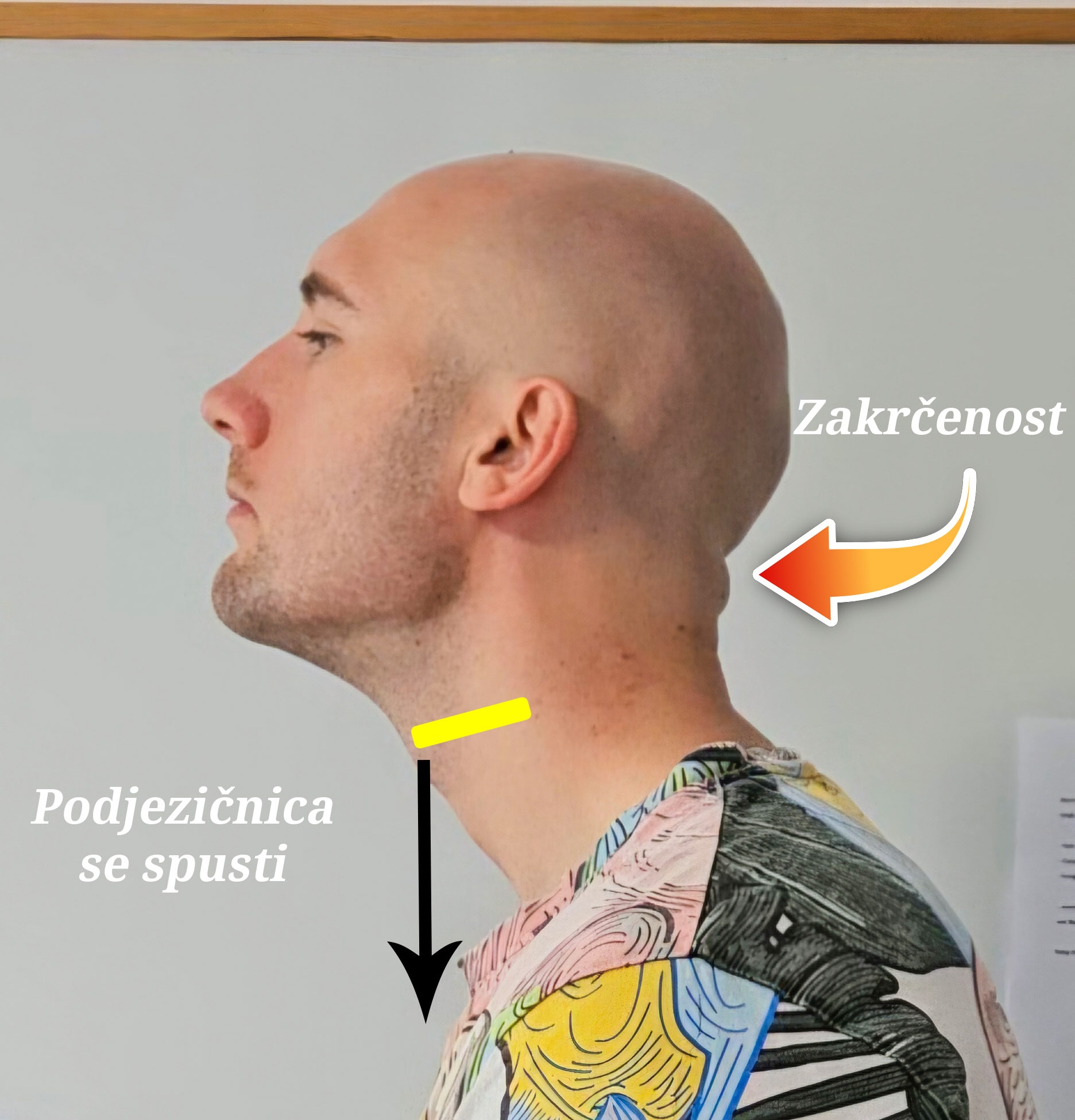 podjezičnica položaj glava potisnjena naprej biomehanika vratu