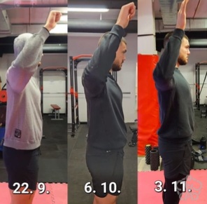 zunanja rotacija ramena napredek po operaciji september oktober november primerjava