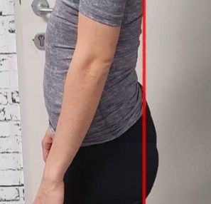 trebuh štrli anteriorni nagib medenice