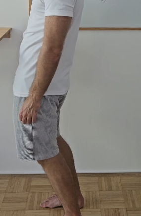 medenica potisnjena naprej izravnana ledvena krivina