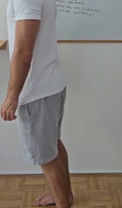 anteriorni nagib medenice poudarjena ledvena krivina