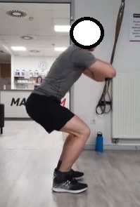 omejen počep anteriorni nagib medenice prsni koš naprej globina zmanjšana