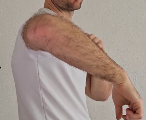 notranja rotacija rame enaka logika kot anteriorni nagib medenice kompenzacija