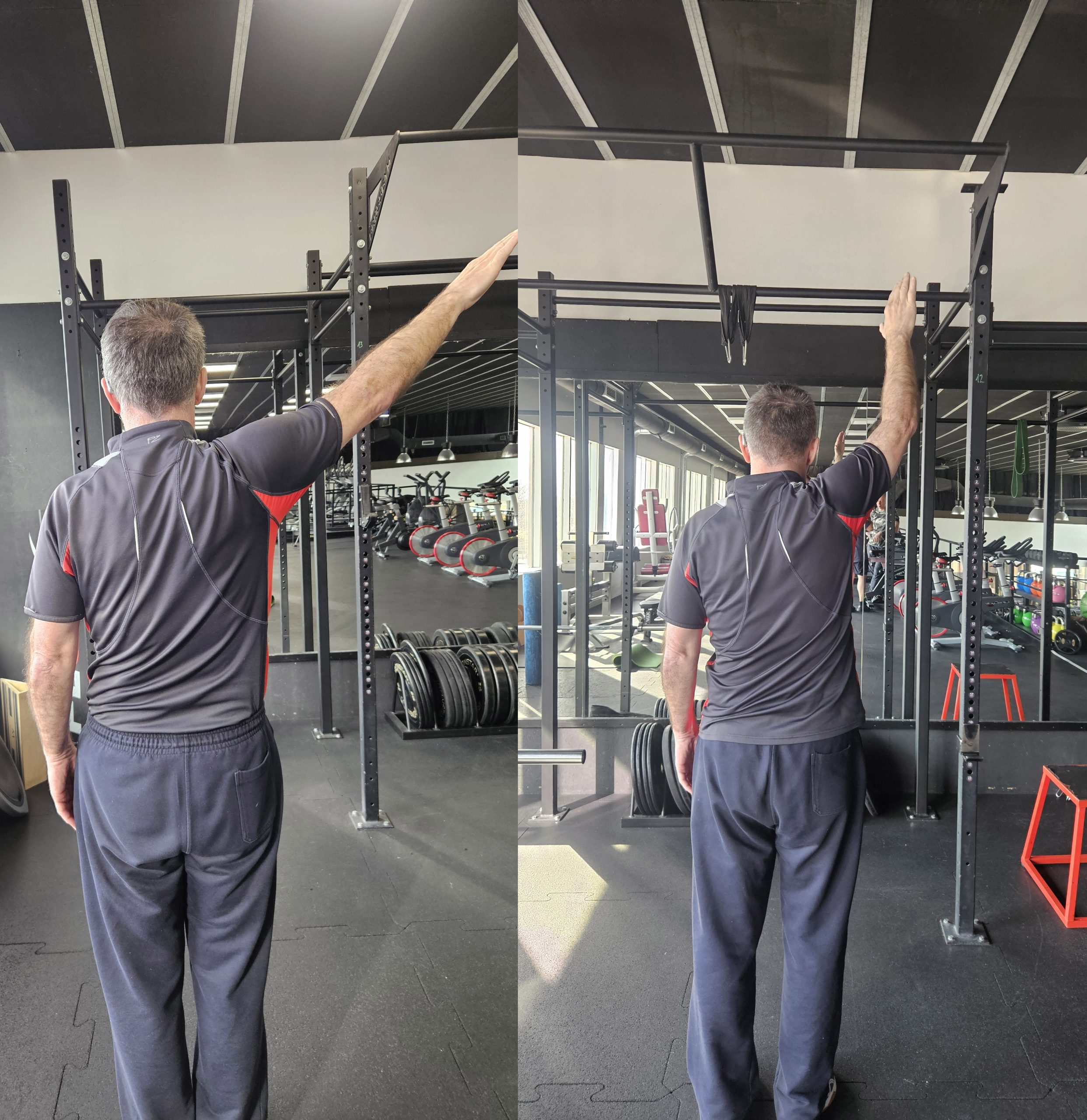 dvig roke nad glavo pred in po vajah rehabilitacija ruptura supraspinatusa napredek